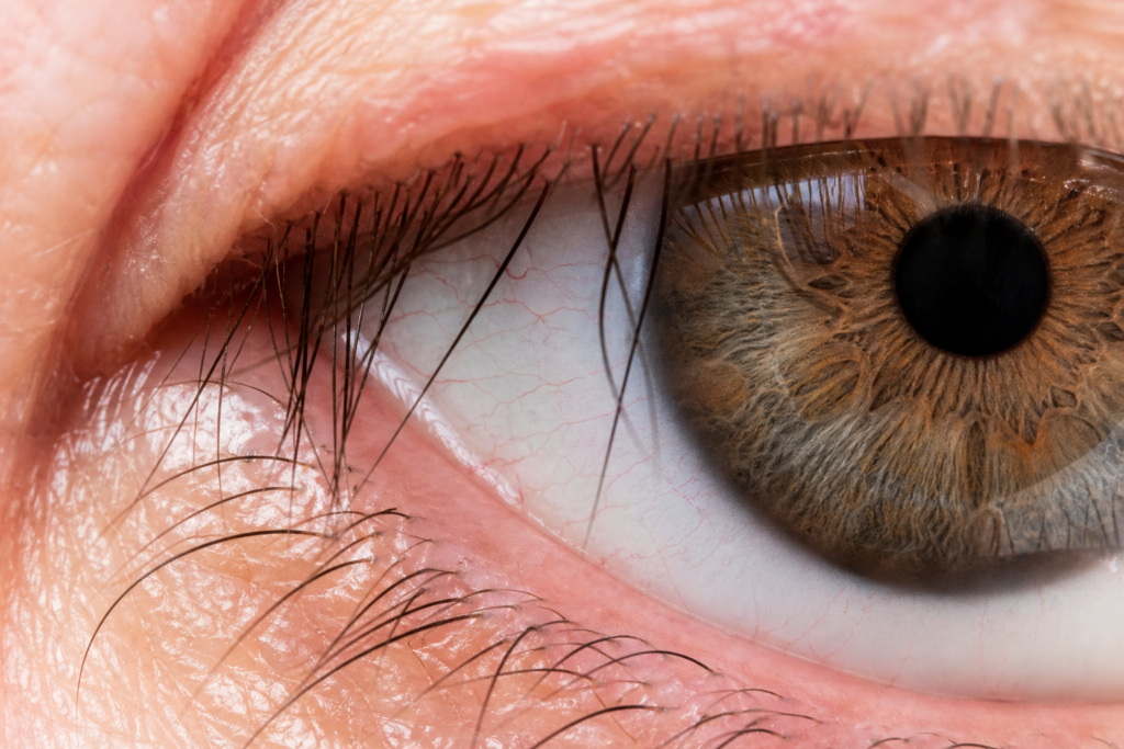 rood oog
